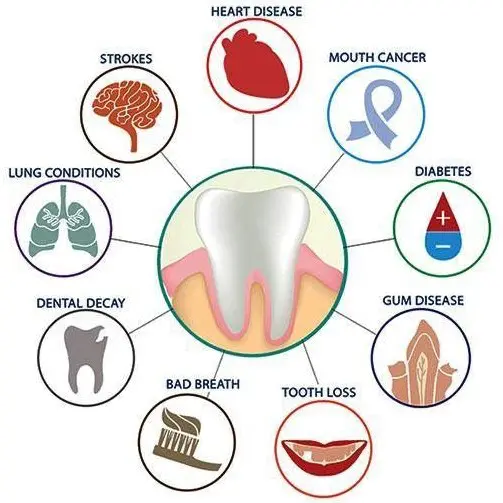 effects of periodontitis | periodontist anchorage ak