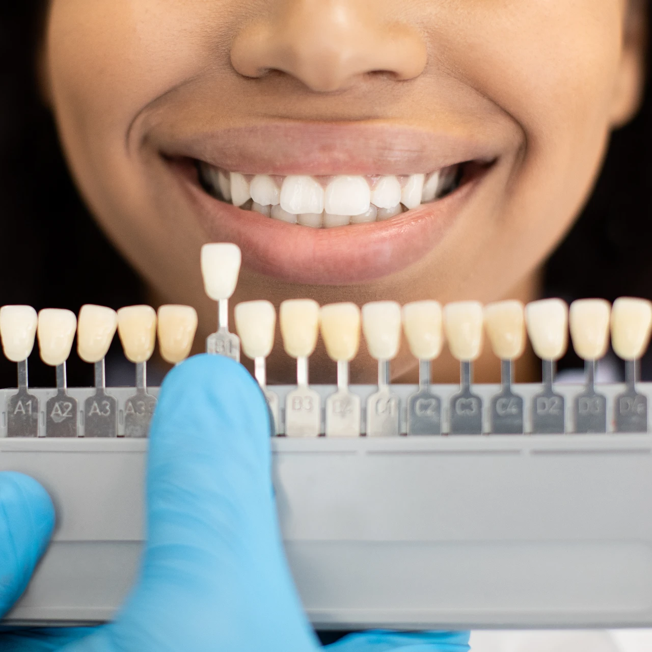 woman comparing different shades of porcelain veneers at dentist office
